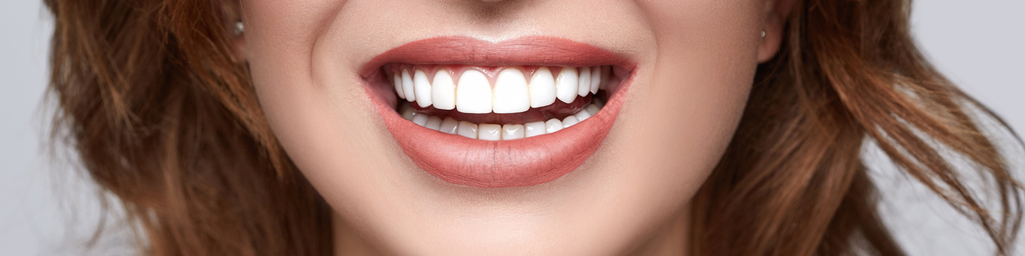 Dental Fillings NYC  Cavity Treatment Dentist - Sohosmile